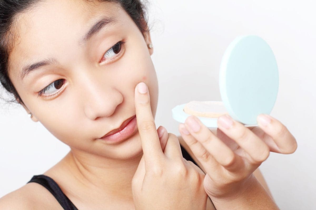 Acne - familydoctor.org