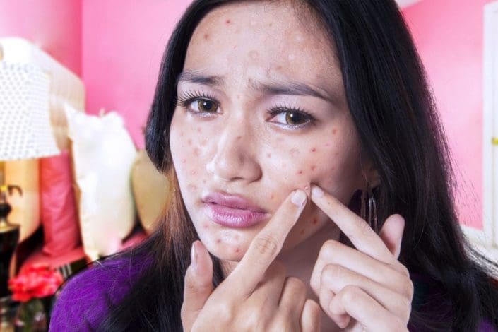 Unhappy teenage girl touching acne on her face