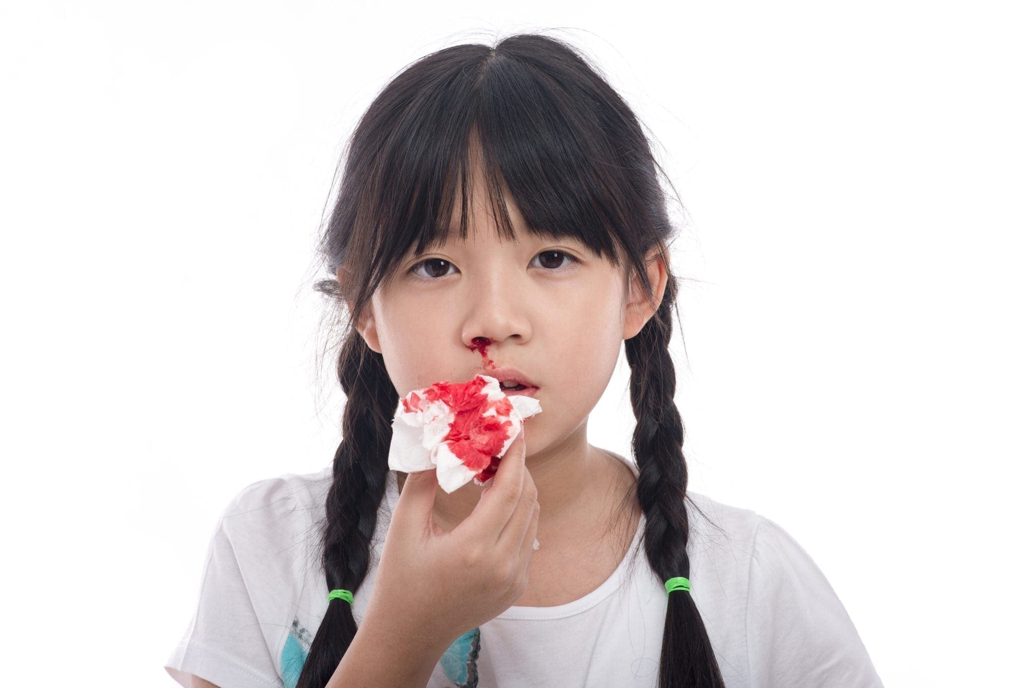 What Causes Kids To Have Nose Bleeds