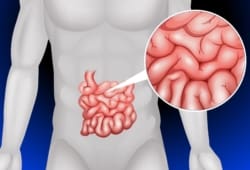 Small intestine in detail illustration. A Meckel’s diverticulum is a small pouch on the wall of the small intestine that can cause stomach pain, vomiting and blood in the stool.