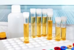 A laboratory rack with several tubes of urine ready for analysis
