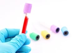 A lab technician holding a blood sample