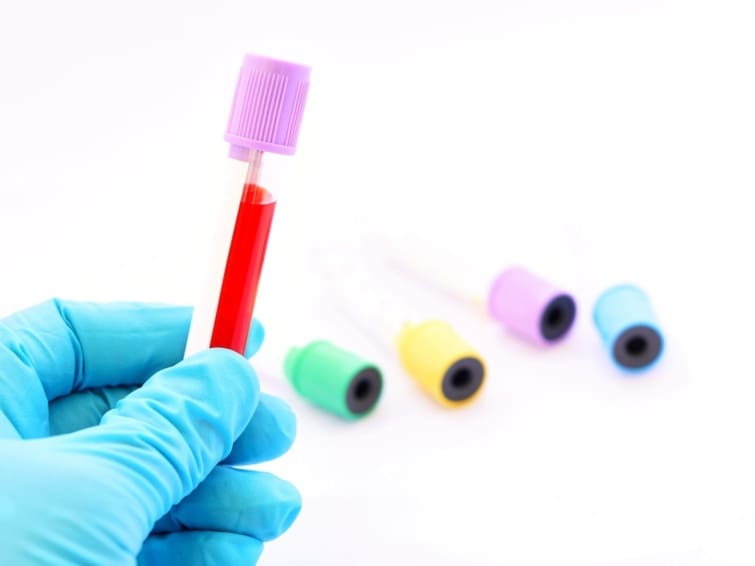 A lab technician holding a blood sample