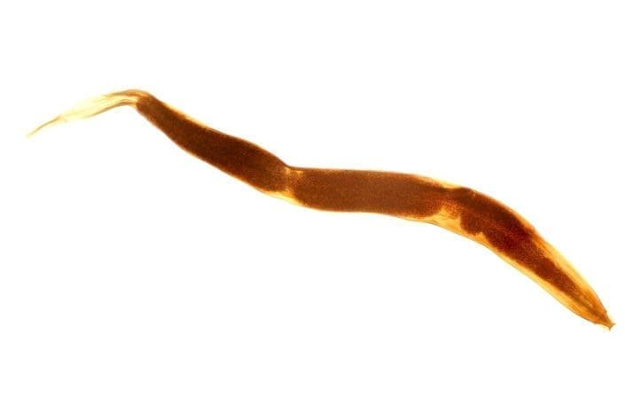 pinworms in poop after treatment