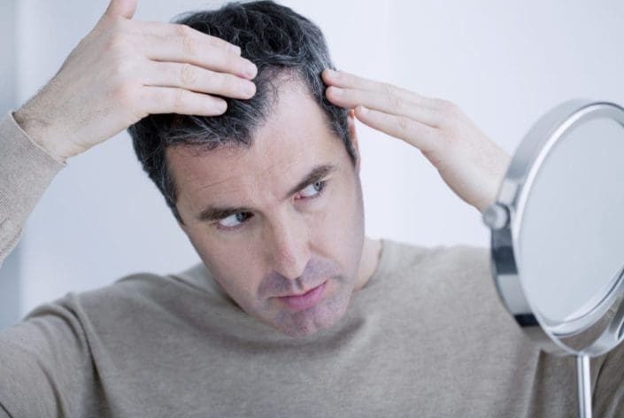 A man looks in the mirror at his receding hairline. It is normal to shed some hair each day. However, some people may experience excessive (more than normal) hair loss for various reasons.