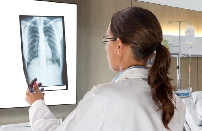 female doctor looking at chest X-ray