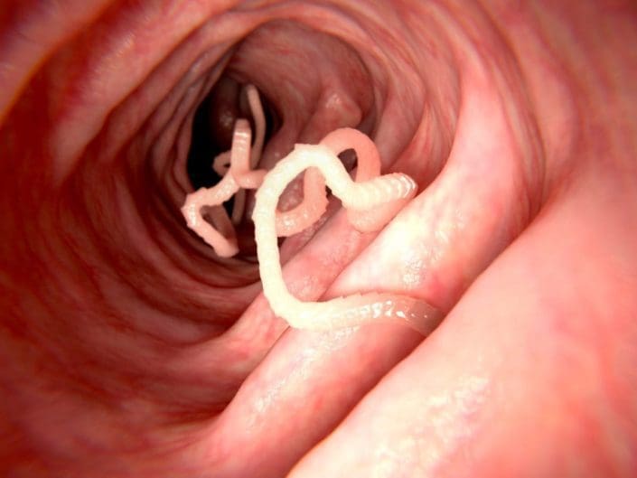 Tapeworm in human intestine