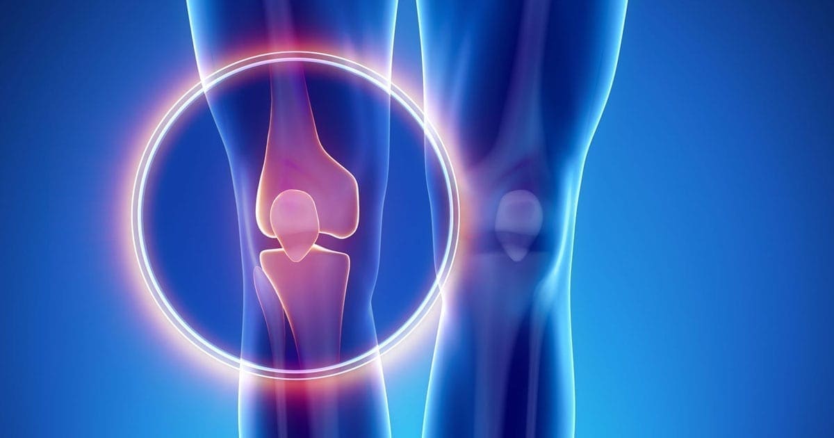 Osteosarcoma - Symptoms And Treatment | familydoctor.org