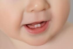 baby’s face smiling, showing two bottom teeth