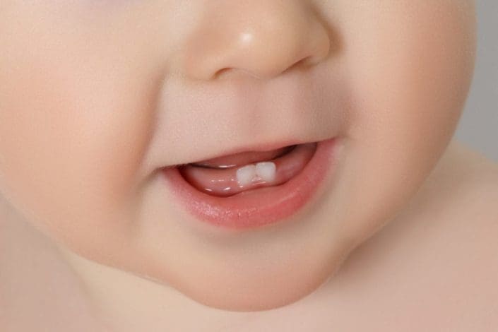 Dental Hygiene How To Care For Your Baby S Teeth Familydoctor Org