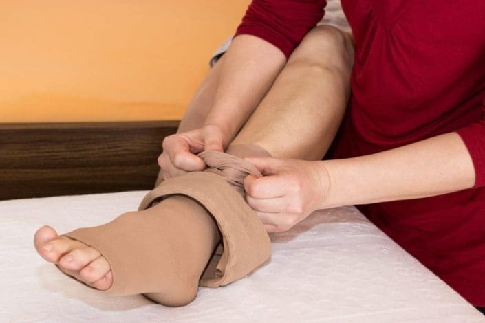 A woman puts on compression stockings. Edema is a swelling or puffiness of part of the body, usually the feet, ankles and legs. It sometimes occurs in the face and hands.