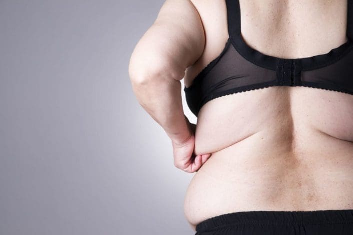 Overweight female with fat folds under her bra clasp in the back