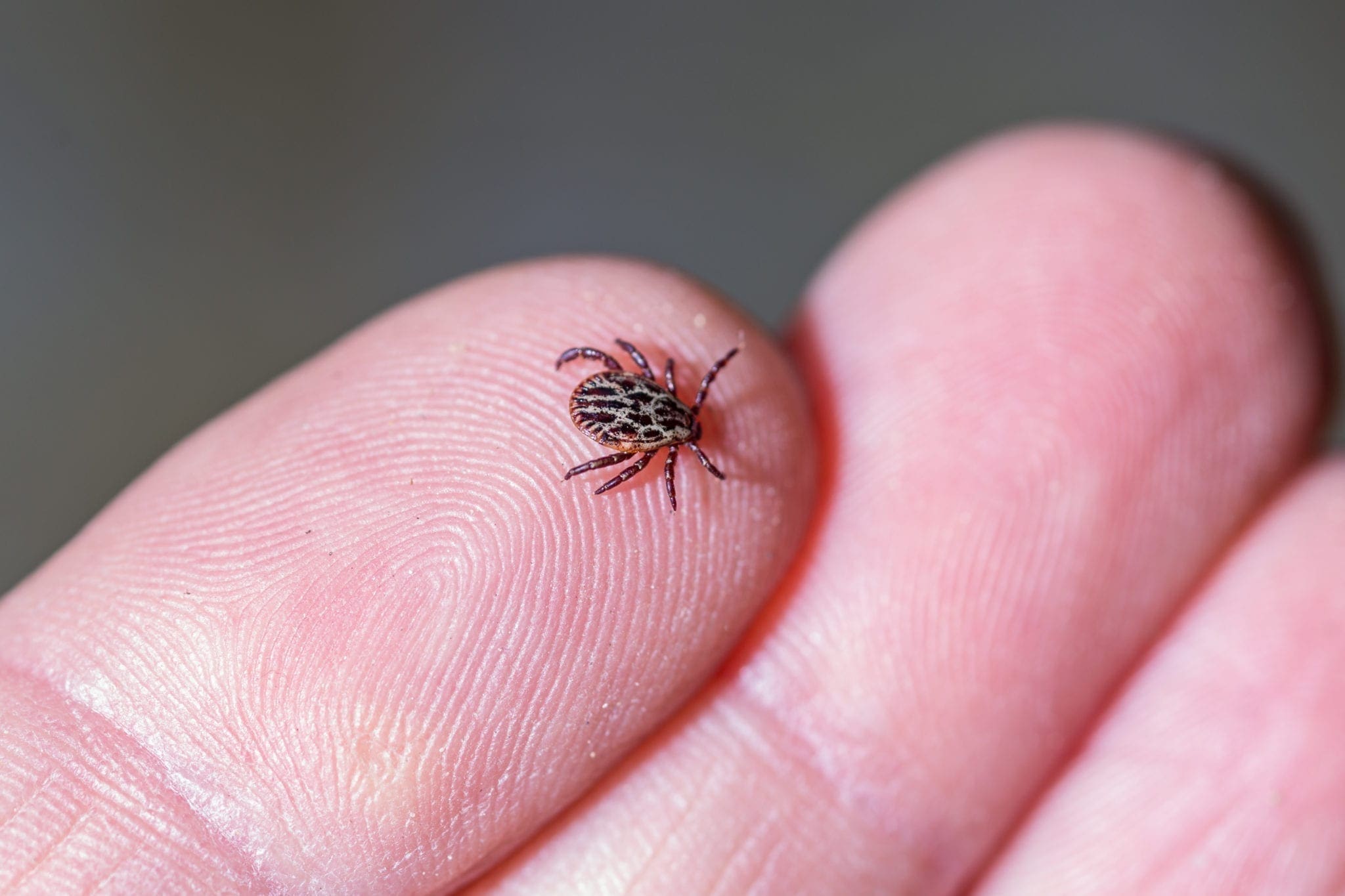 Tick Borne Relapsing Fever Symptoms 3635