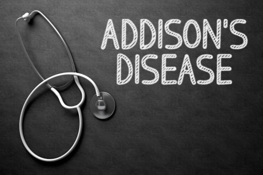 Stethoscope resting on black chalkboard with the words Addison’s Disease