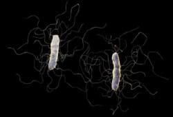 C. diff., or clostridium difficile, bacterium isolated on black background. A clostridium difficile (C. diff.) infection is a bacterial infection in your intestines. C. diff. infections can range from mild to severe.
