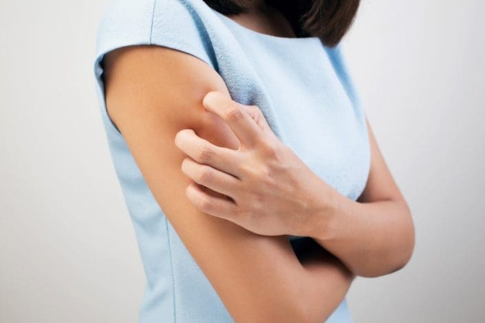 a woman with keratosis pilaris scratches the back of her arm