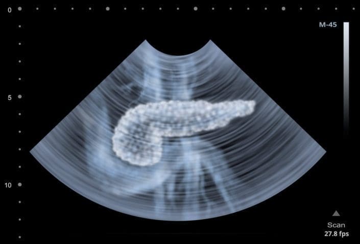 illustration of an ultrasound picture of the pancreas