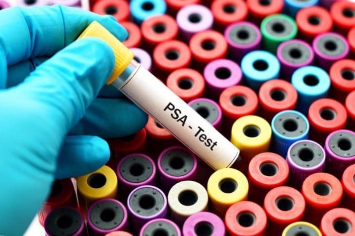 Healthcare worker holding blood sample for PSA test