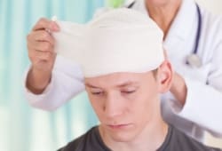 Female doctor wrapping the head of a young man with gauze