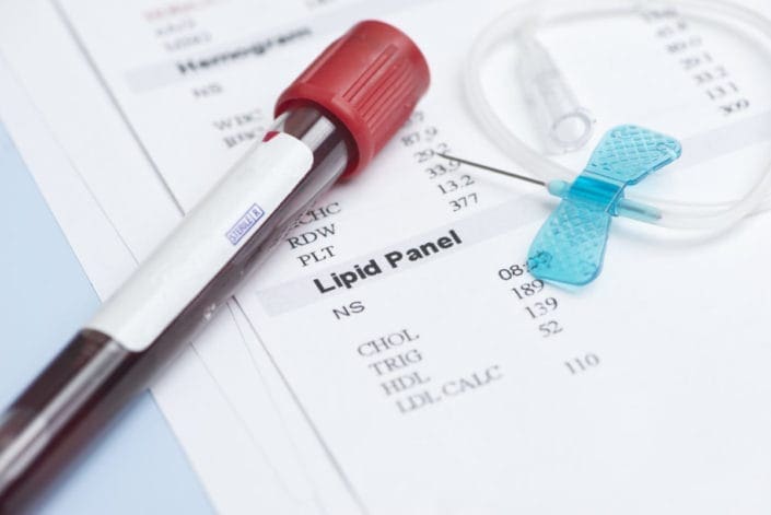 Blood Test: Lipid Panel - familydoctor.org