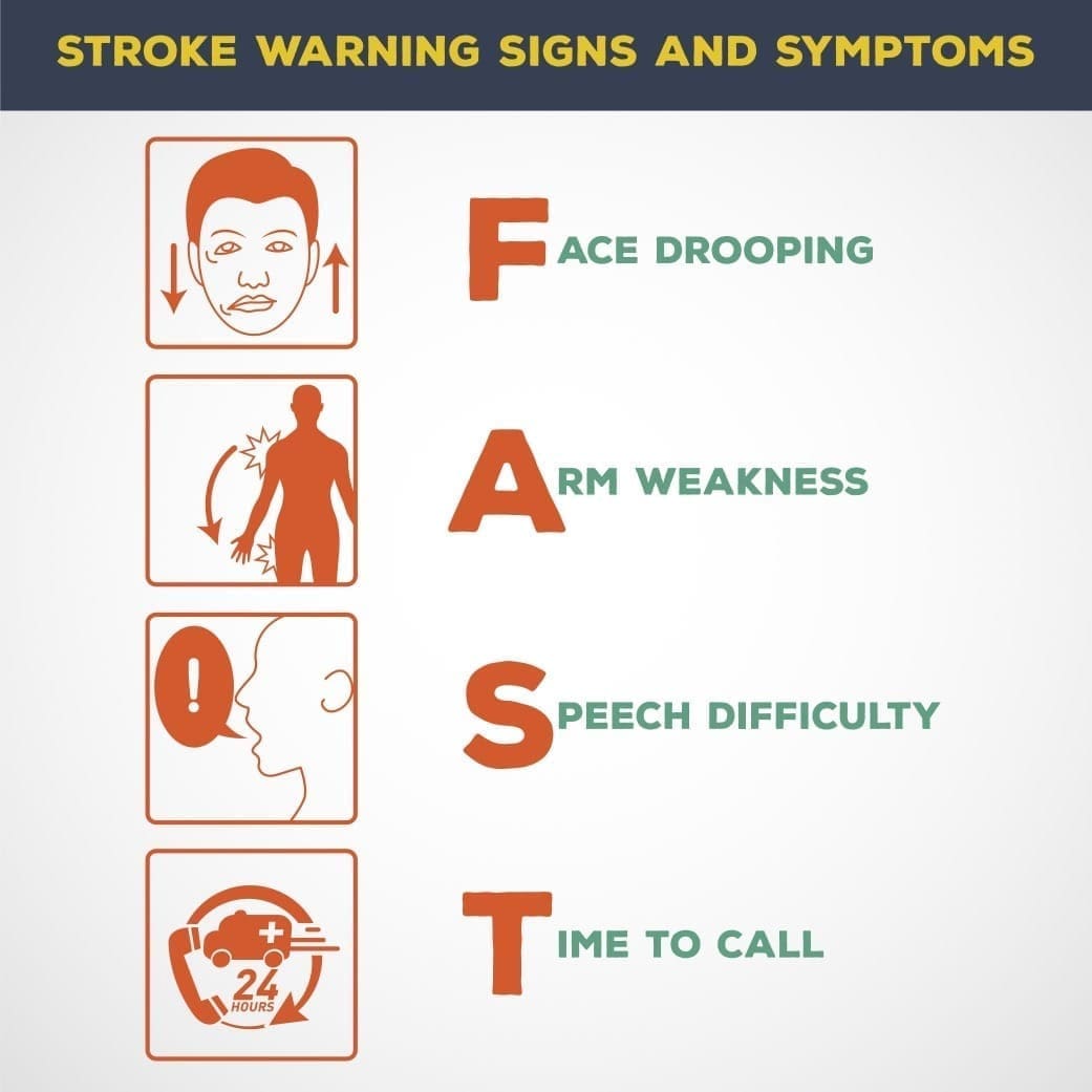 Sign explaining the warning signs and symptoms of a stroke (FAST acronym)