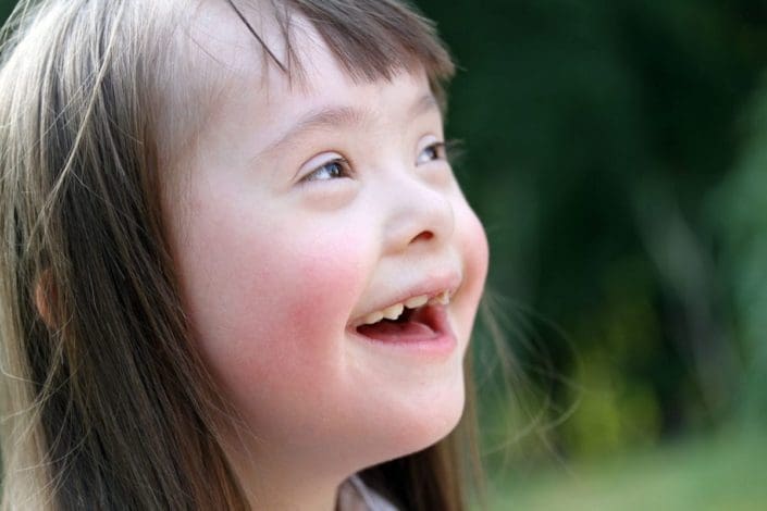 Down Syndrome - familydoctor.org