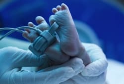 Newborn baby under ultraviolet lamp in the incubator, doctor s hand care for a sick new born in the pediatric ICU