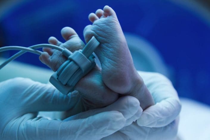 Newborn baby under ultraviolet lamp in the incubator, doctor s hand care for a sick new born in the pediatric ICU
