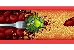 illustration of a cholesterol-blocked artery being cleared out with a forkful of green vegetables