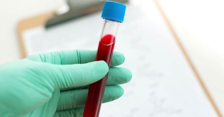 Blood Test: Lipid Panel - familydoctor.org