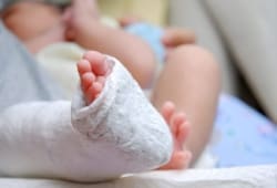 A photo of a baby who has on a cast on his leg