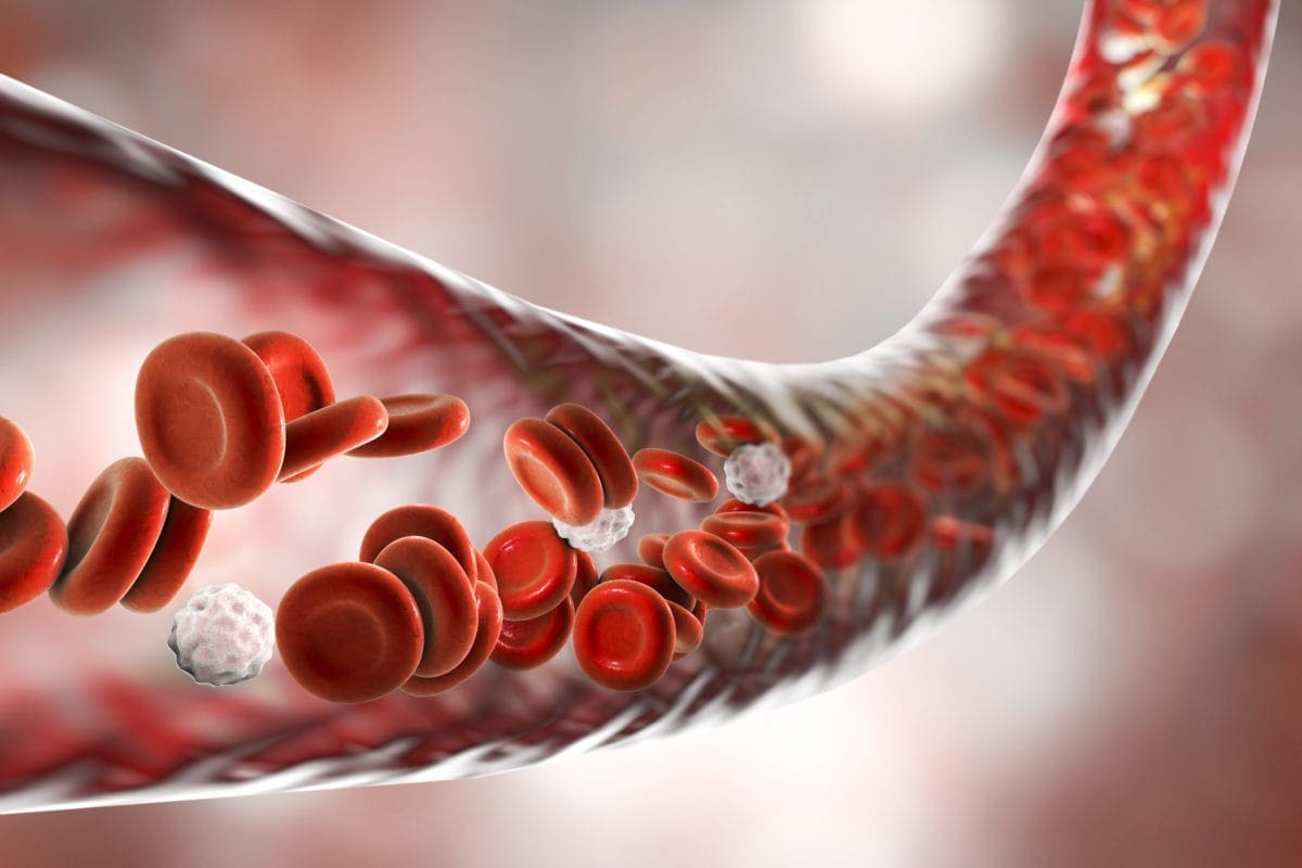 What Happens If A Kidney Infection Gets In Your Bloodstream