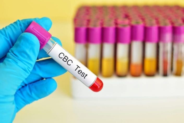 Gloved hand holding blood sample for complete blood count (CBC) test