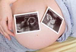 Pregnant woman with two ultrasound scans of twins resting on her belly