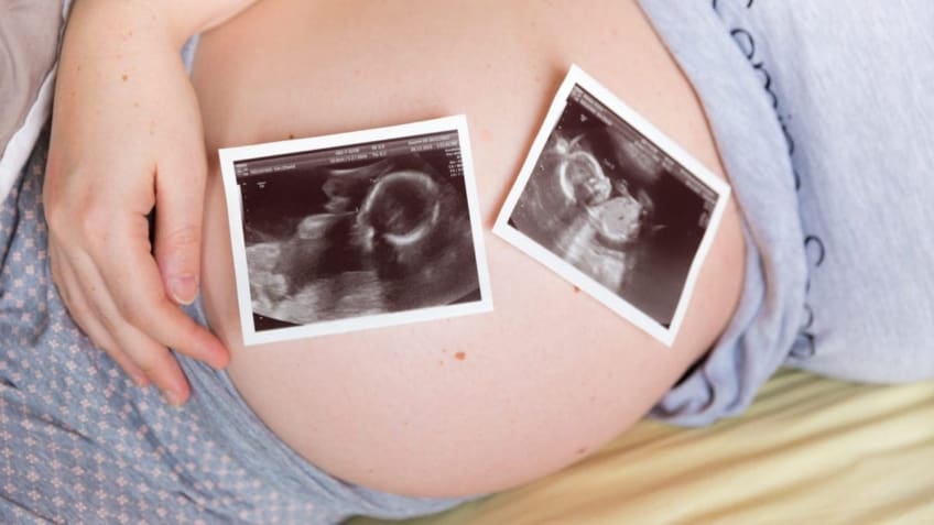 Pregnant woman with two ultrasound scans of twins resting on her belly