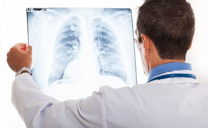 chest x ray