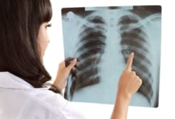 Female doctor examines X-ray of a patient’s lungs