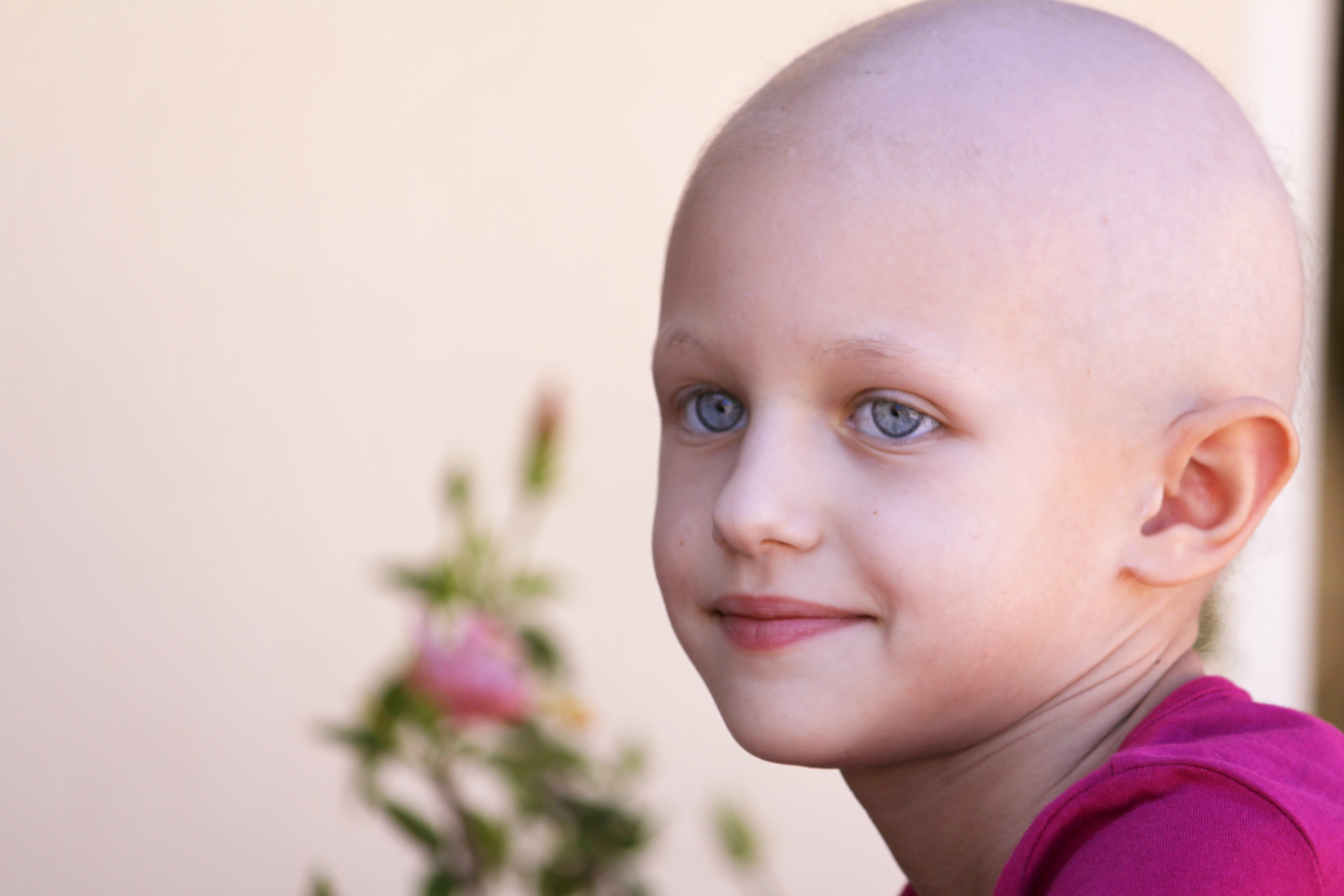 A close-up photo of a young girl without hair. Leukemia is a cancer involving the body’s white blood cells and bone marrow. It is most common in adults over 60, but kids can also get it.