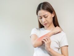 Pruritus (Itchy Skin)
