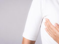 Galactorrhea