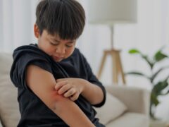 Mastocytosis