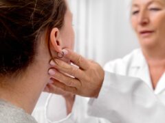 Mononucleosis
