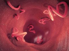 Echinococcosis