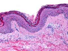 Thin skin showing the epidermis with its different strata, resting on the dermis.
