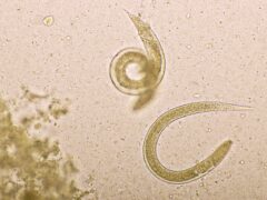 Strongyloides stercoralis or threadworm in human stool, analyze by microscope, original magnification 400x