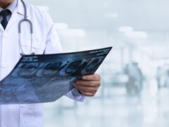 Orthopedics surgeon doctor examining patient's knee joint x-ray films, MRI bone, CT scan in at radiology unit, hospital background. knee joint film x ray, healthcare and medicine concept, close up