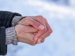 Women's frozen hands in the cold.Women's hands with dry skin and red fingers in the cold in winter.The concept of skin care in winter.