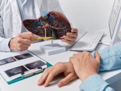 Human liver model on doctor's table, close-up. Treatment of hepatitis, cirrhosis and liver cancer