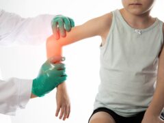 The hands of a traumatologist doctor in green medical gloves examine the girl s damaged elbow joint. Injury and dislocation of the elbow joint, bruise and fracture. Growing pains
