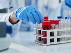 Science, blood test and hands of person with sample for biotech engineering, pathology and hematology research. Laboratory, exam and scientist with glucose analysis, development or medical study.